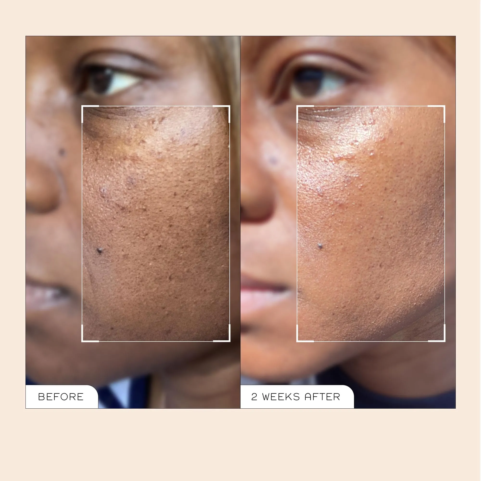 Mini Radiance Ready Steady Glow Daily AHA Tonic